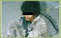Mentally ill roadside destitutes
